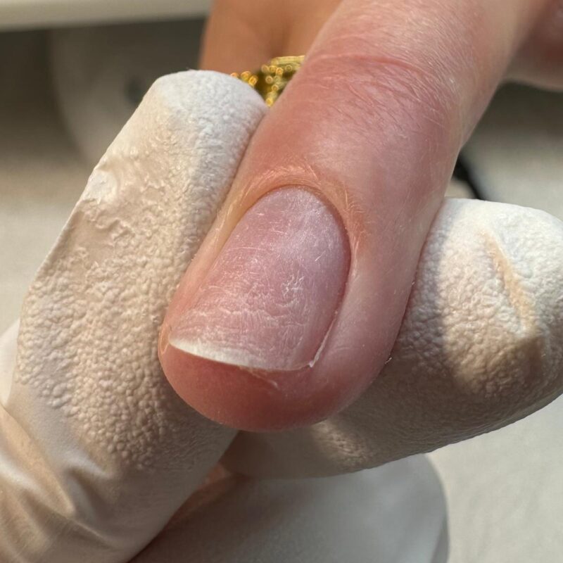 Russian manicure nail preparation, skin polishing, cuticle removal
